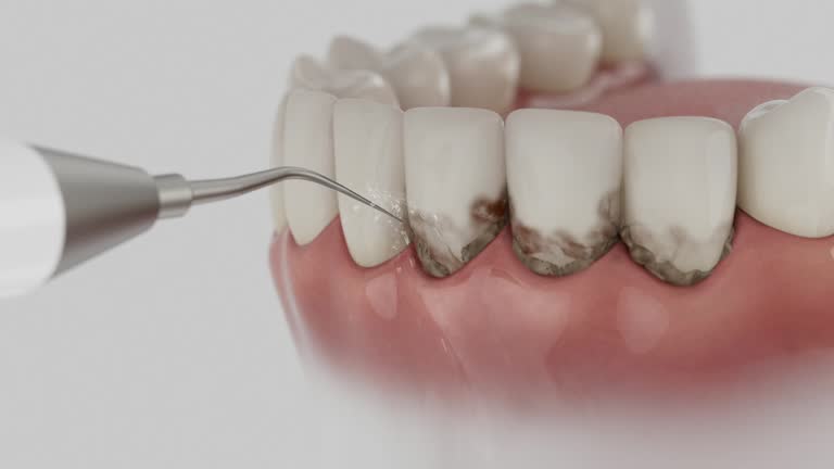 Reliable Dental contractor in Waupaca, WI by Smile Center Dentistry